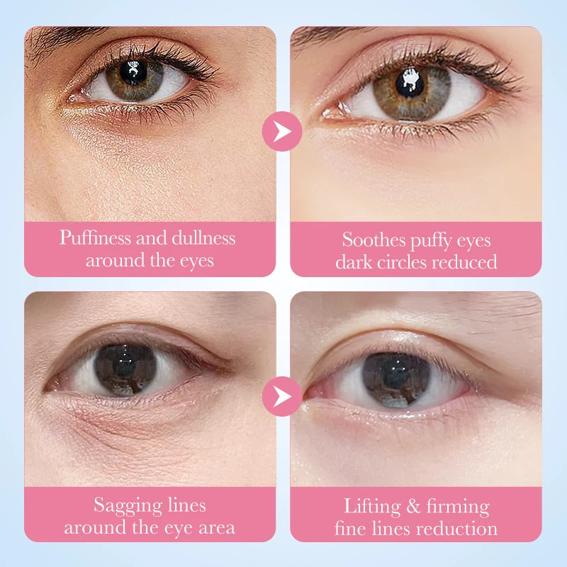 Collagen Eye Treatment Mask 60pcs - Sakura Formula Nourishes & Firms, Reduces Dark Circles & Puffiness, Hydrates & Brightens.