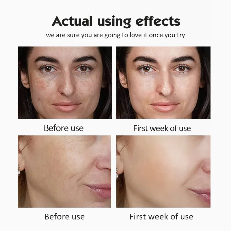 20% Vitamin C Ampoule Serum Set  Moisturising Whitening Wrinkle Reducing Anti-Ageing Serum Face Beauty Skin Care