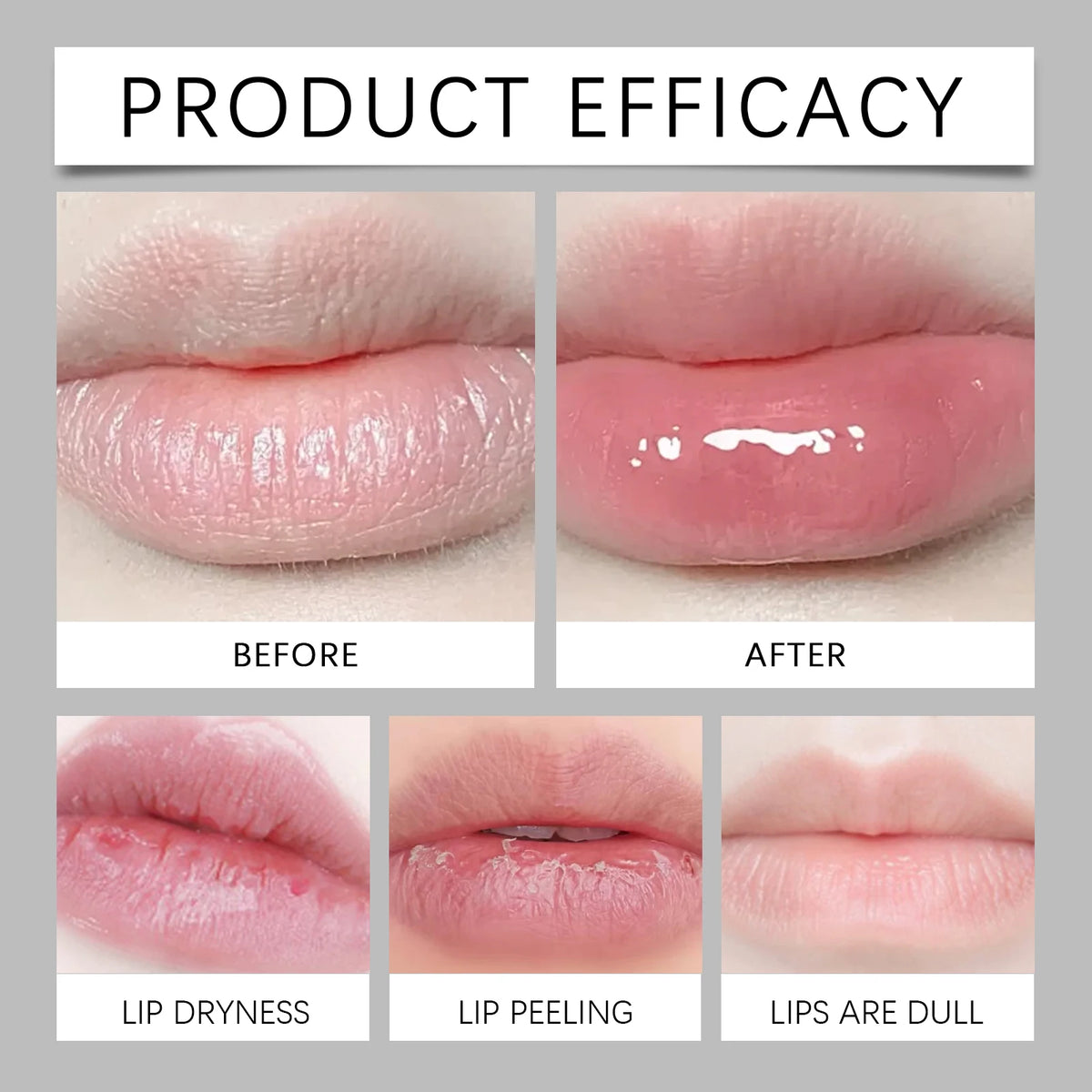 HOYGI Hyaluronic Acid Lip Balm Lasting Moisturizing Anti Cracked and Dryness Lighten Melanin Brighten Lips Gentle No Greasy 20g