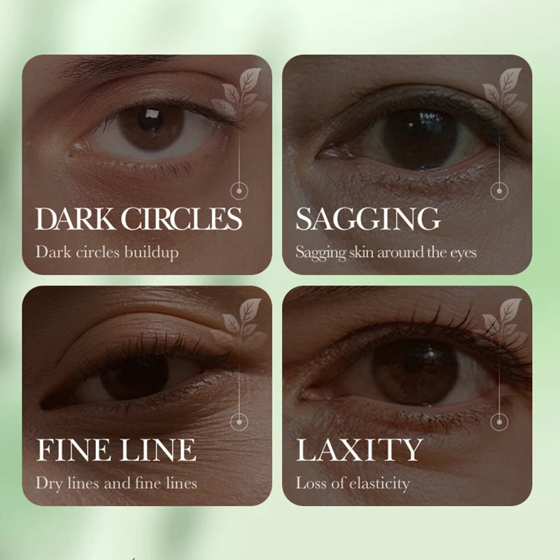 80pcs SADOER Betula Alba Juice Eye Mask Moisturizing Anti Dark Circle Remove Eye Bags Anti-aging Anti Wrinkles Eye Patches