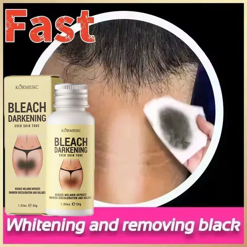 Body Whitening Cream Private Parts Underarm Bleaching Serum Whiten Butt Knee Brighten Inner Thigh Intimate Dark Remove Melanin