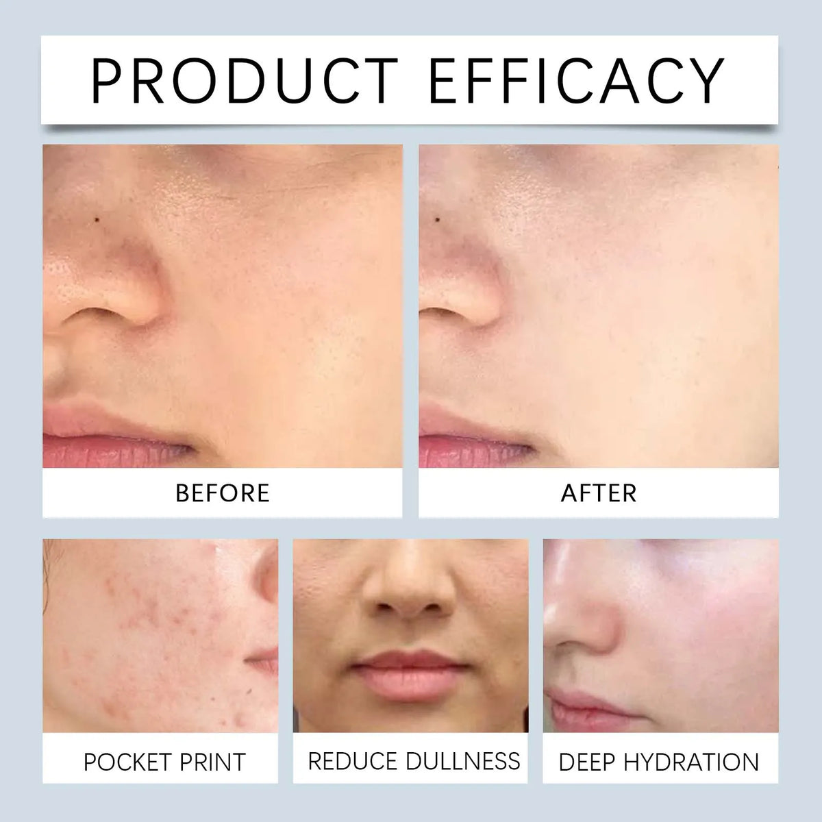 HOYGI Glycolic Acid Toning Solution To Remove Acne Moisturizing Toner Relieve Dry Tired Skin Locks In Moisture Beauty Skin Care