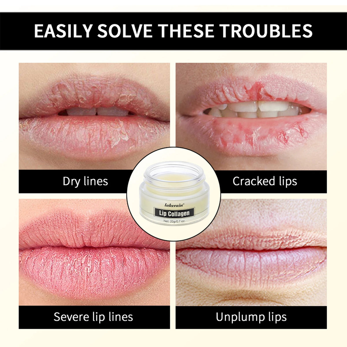 Lip Collagen Collagen Lip Mask Lip Balm To Moisturizes Dry Lips Smooths Fine Lines, Deep Hydrates Lip Moisturizer For Exfoliatin